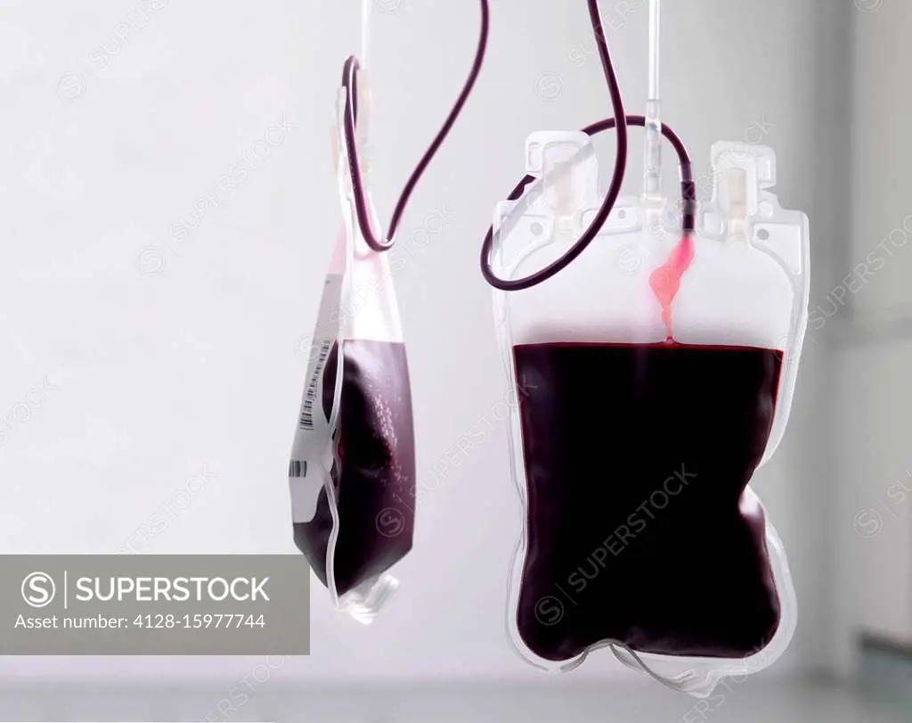 Donor blood processing. The donor blood is being separated into its component parts.