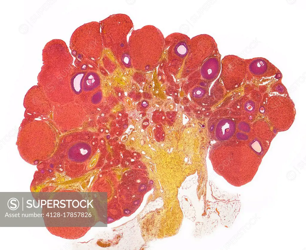 Ovary. Light micrograph (LM) of a section through the whole ovary. The cortex (outer region) contains numerous corpora lutea (red) and follicles (purp...