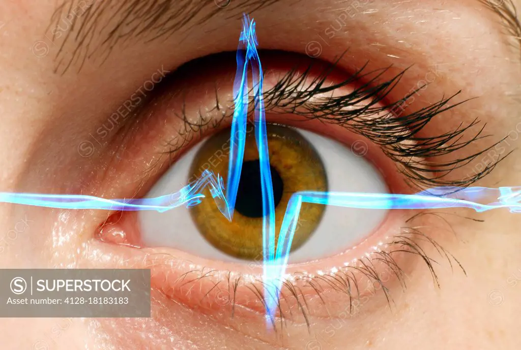 Human eye and electrocardiogram, conceptual composite image