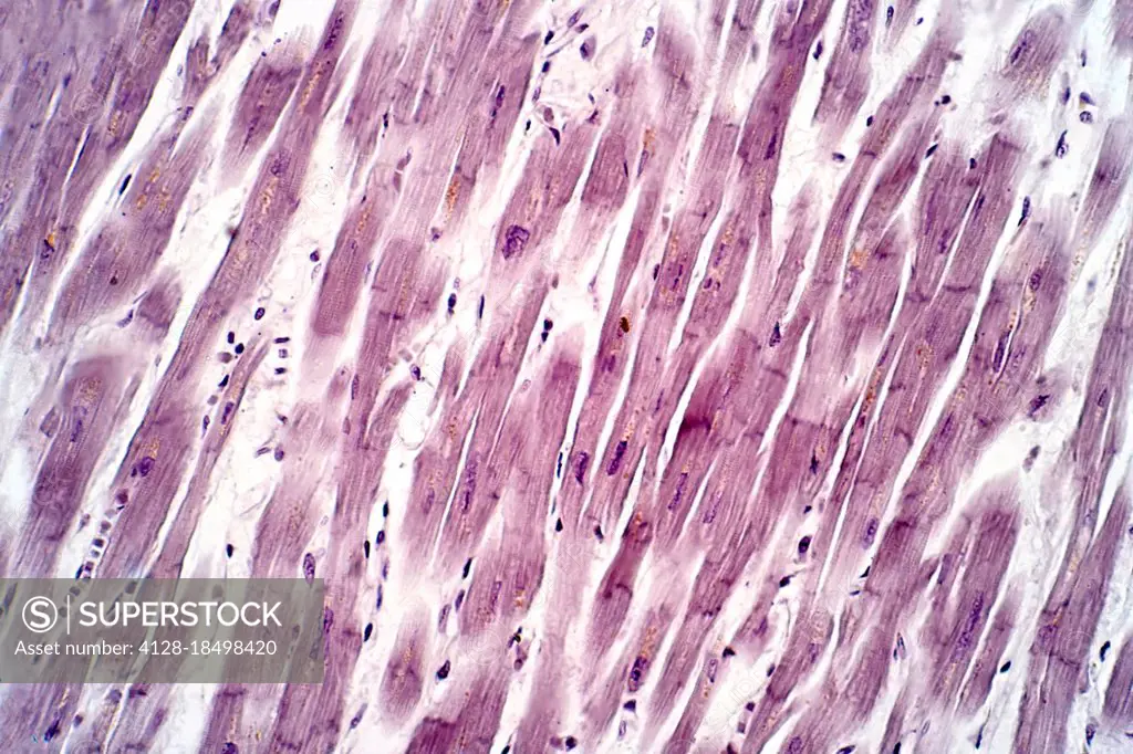 Human cardiac tissue, light micrograph