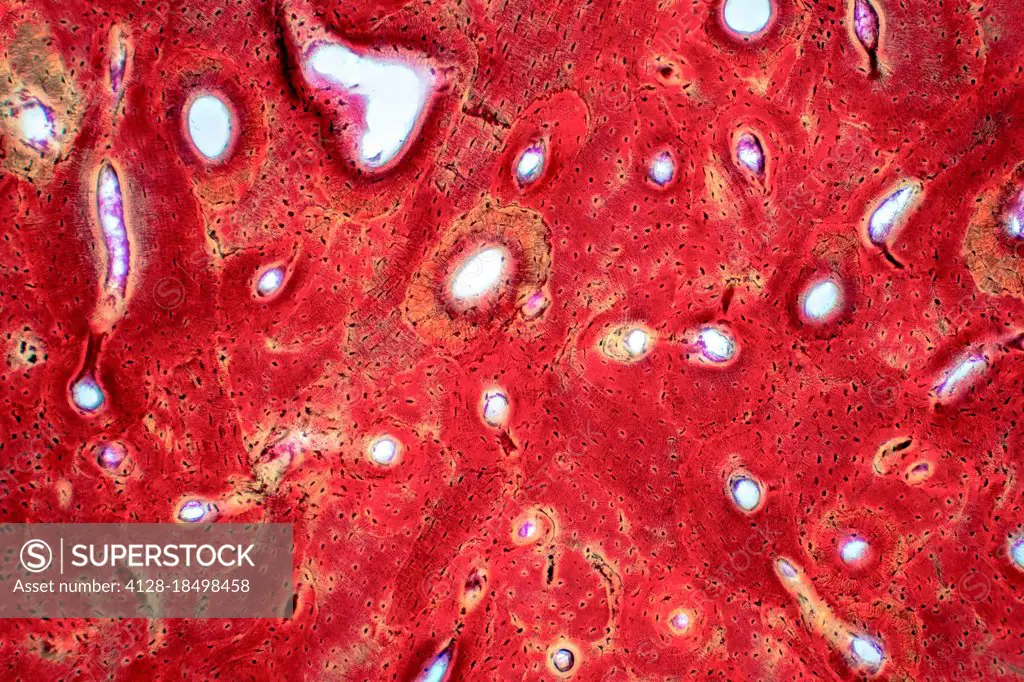 Human compact bone tissue, light micrograph