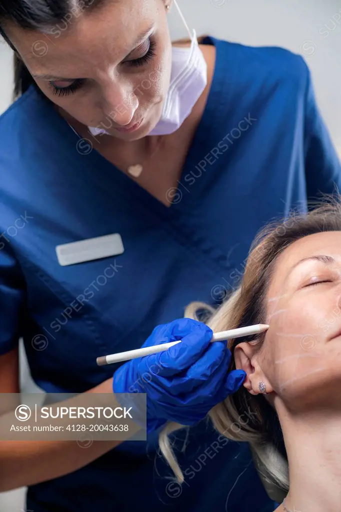 Mesotherapy thread face lift procedure