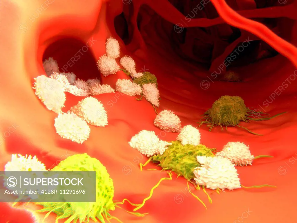 Artwork of t-lymphocytes attacking cancer cells.