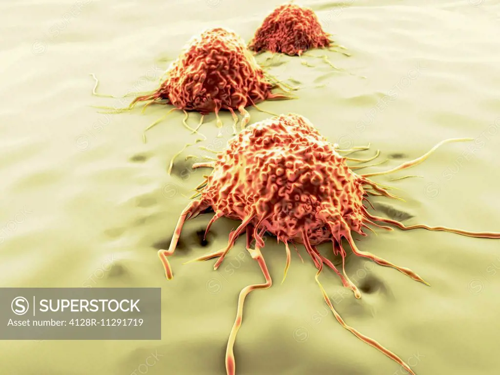 Artwork of migrating cancer cells.