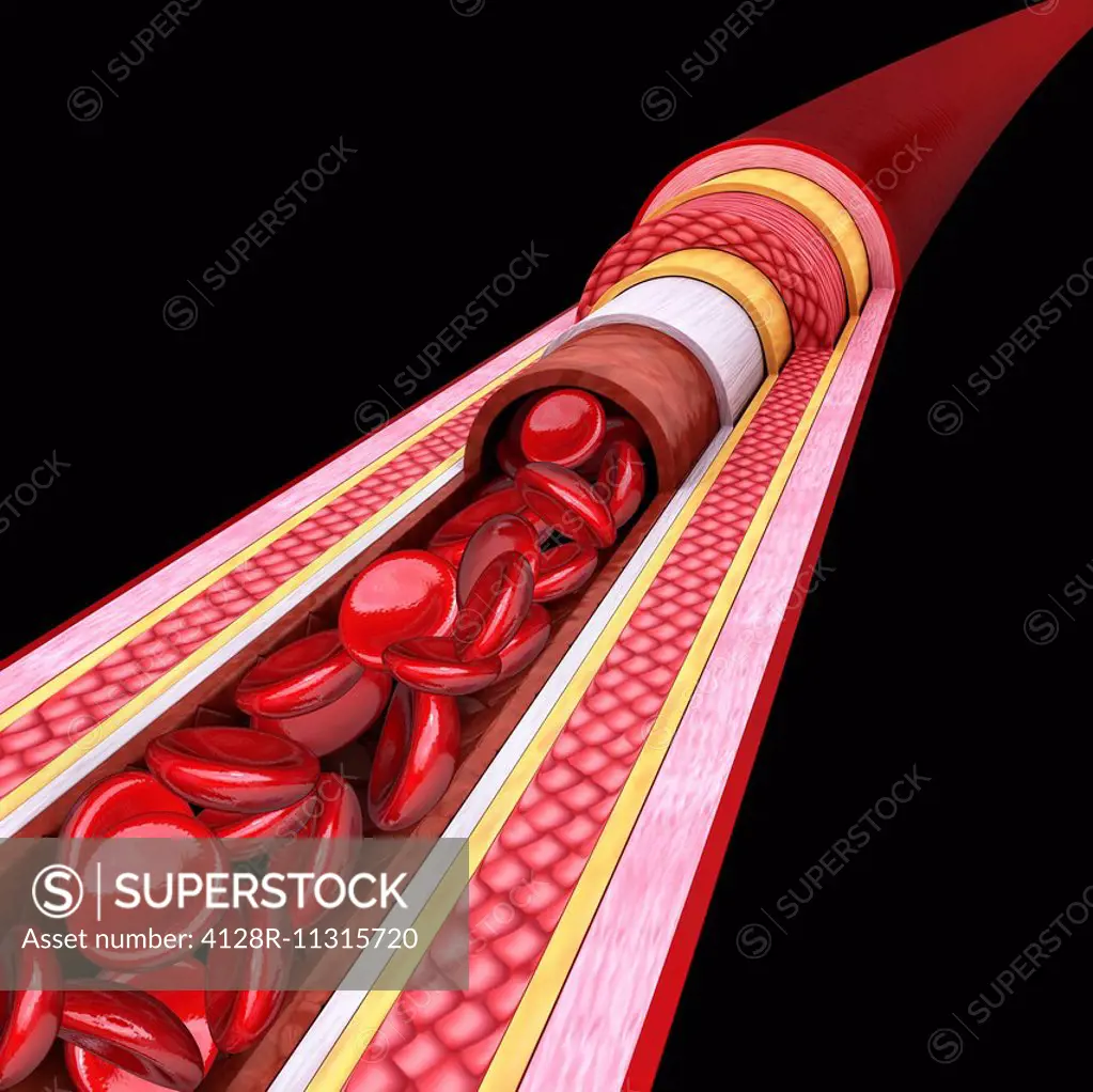 Human artery, cut-away computer artwork.