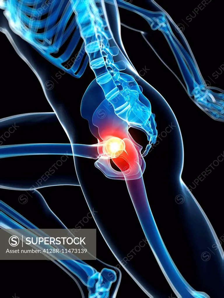 Human anatomy of a runner's hip joint, computer artwork.