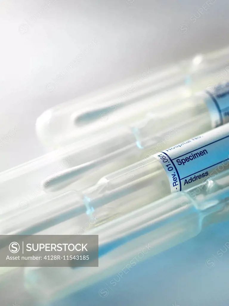 Buccal swabs used to obtain deoxyribonucleic acid (dna) samples.