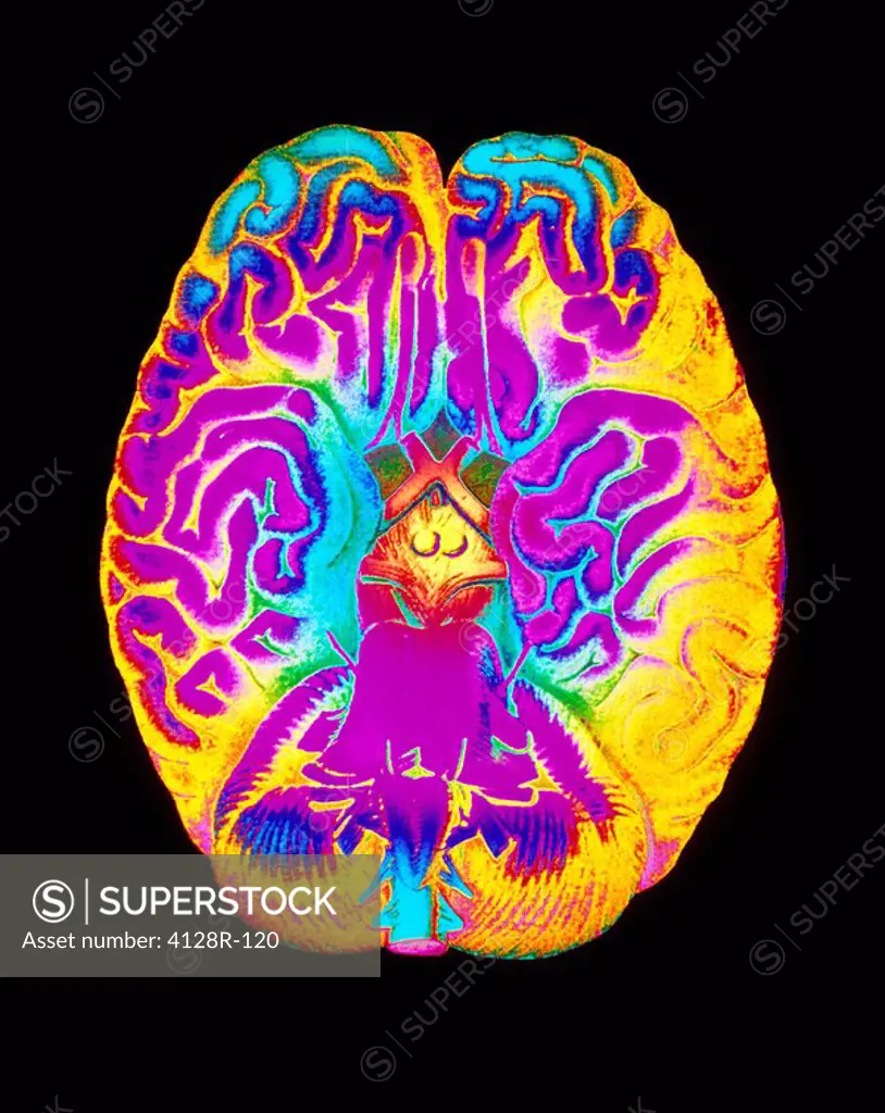 Mascagni artwork of human brain & blood vessels