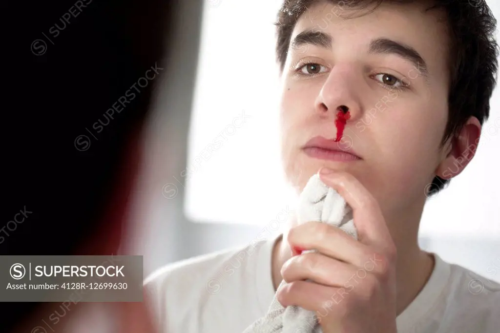 MODEL RELEASED. Young man with a nose bleed.
