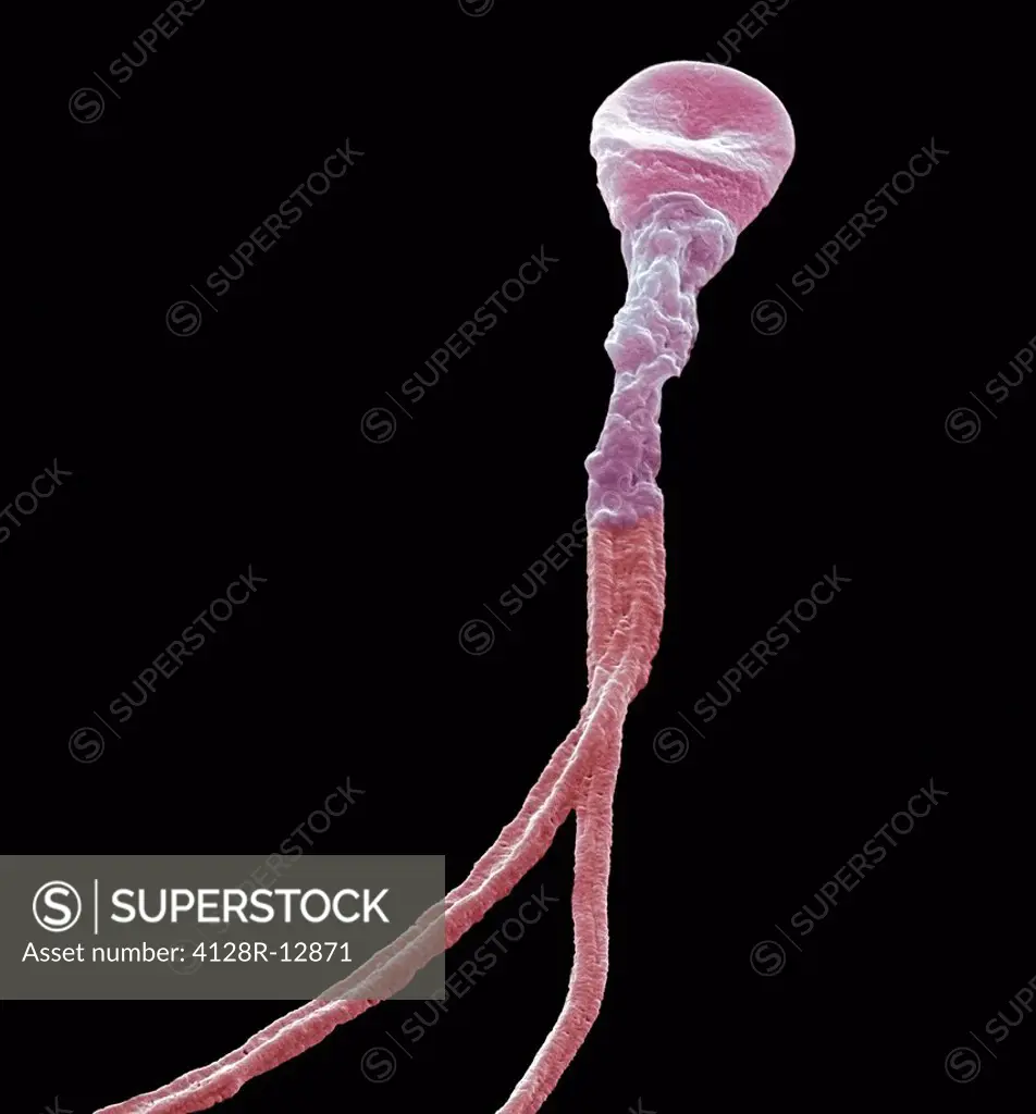Deformed sperm cell. Coloured scanning electron micrograph SEM of a sperm cell with multiple tails. Magnification: x5000 when printed at 10 centimetre...