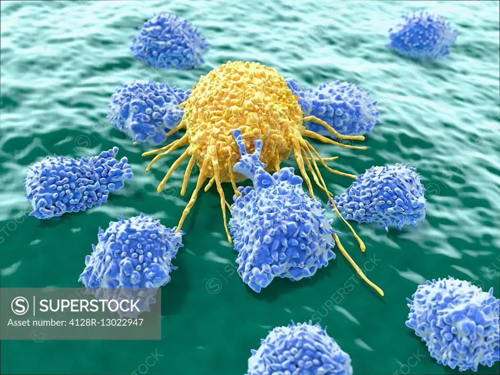 Illustration of lymphocytes attacking a cancer cell. Natural killer cells are a type of lymphocyte that destroys cancer cells and other altered cells ...