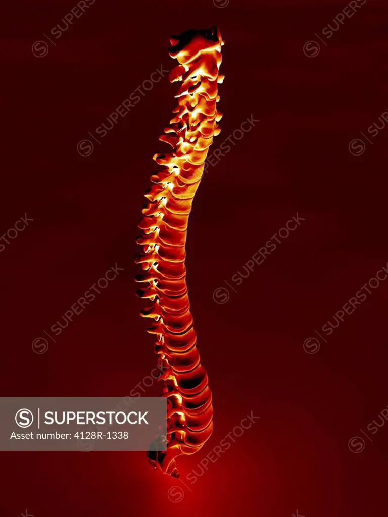 Human spine, artwork
