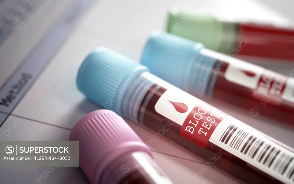Blood samples in blood test tubes.