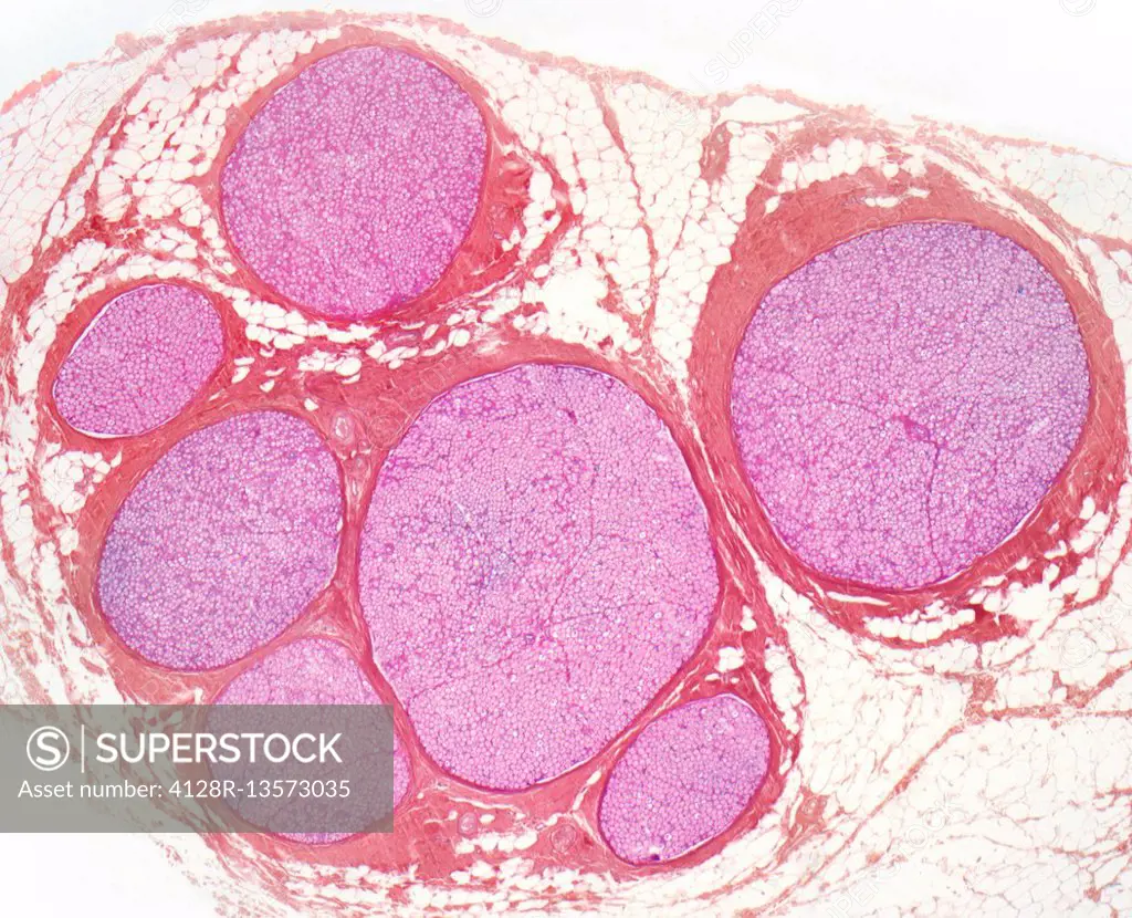Nerve fibres. Light micrograph (LM) of a transverse section through a bundle (fascicle) of nerve fibres. Within each fascicle are many myelinated nerv...