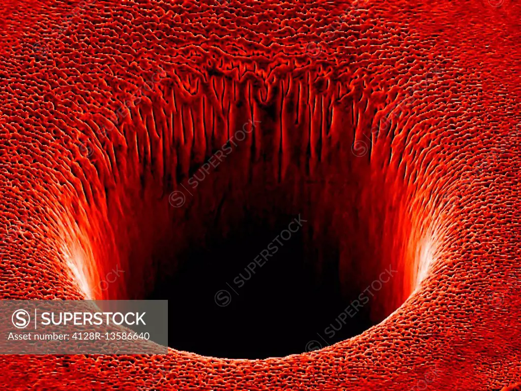 Metal crater formed by a laser. Coloured scanning electron micrograph (SEM) of a nanoscale crater formed on a metal surface by a laser beam. This rese...