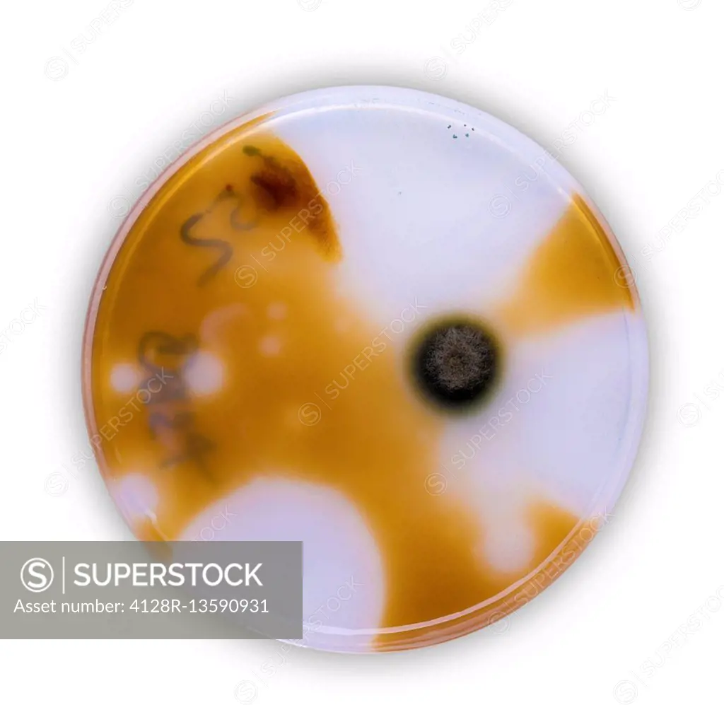 Petri dish growing sample against a white background.