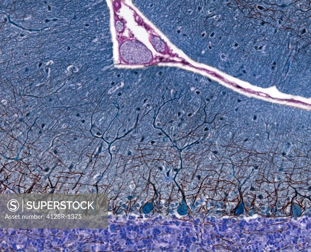 Purkinje cells. Light micrograph of a section through the cerebellum, which has been treated with silver stains, showing pukinje cells dark blue and t...