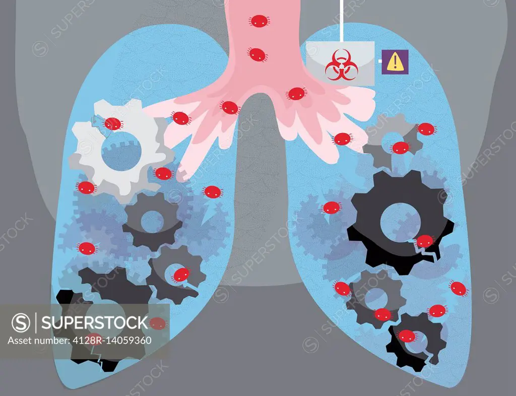 Illustration of human lungs infected by virus