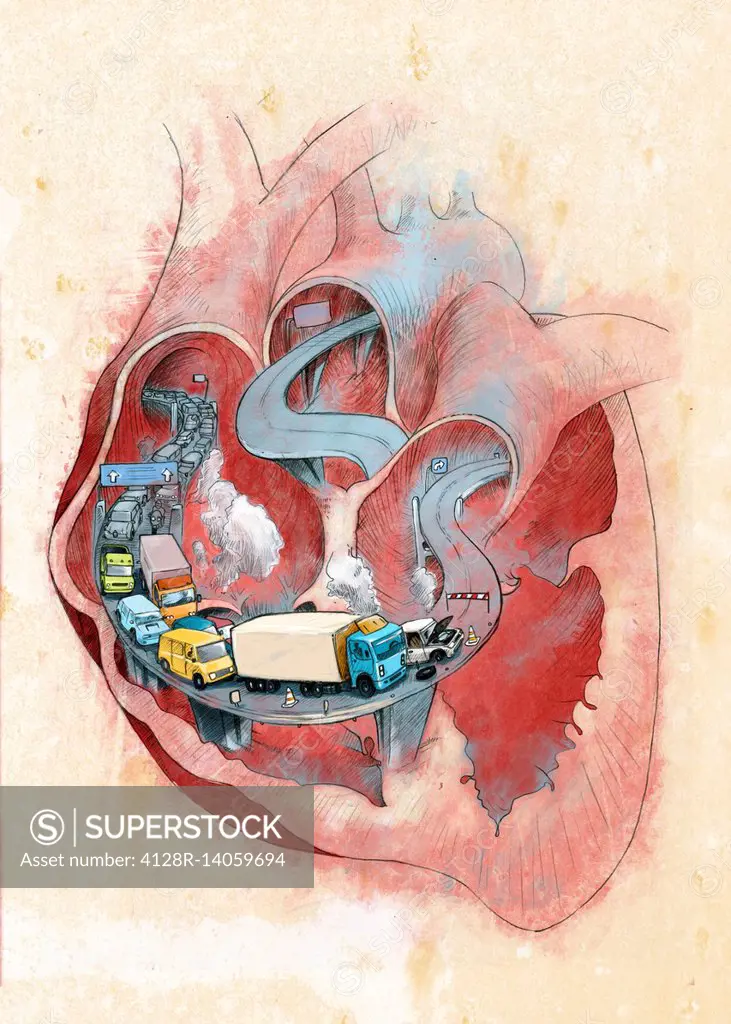 Clogged heart, conceptual illustration