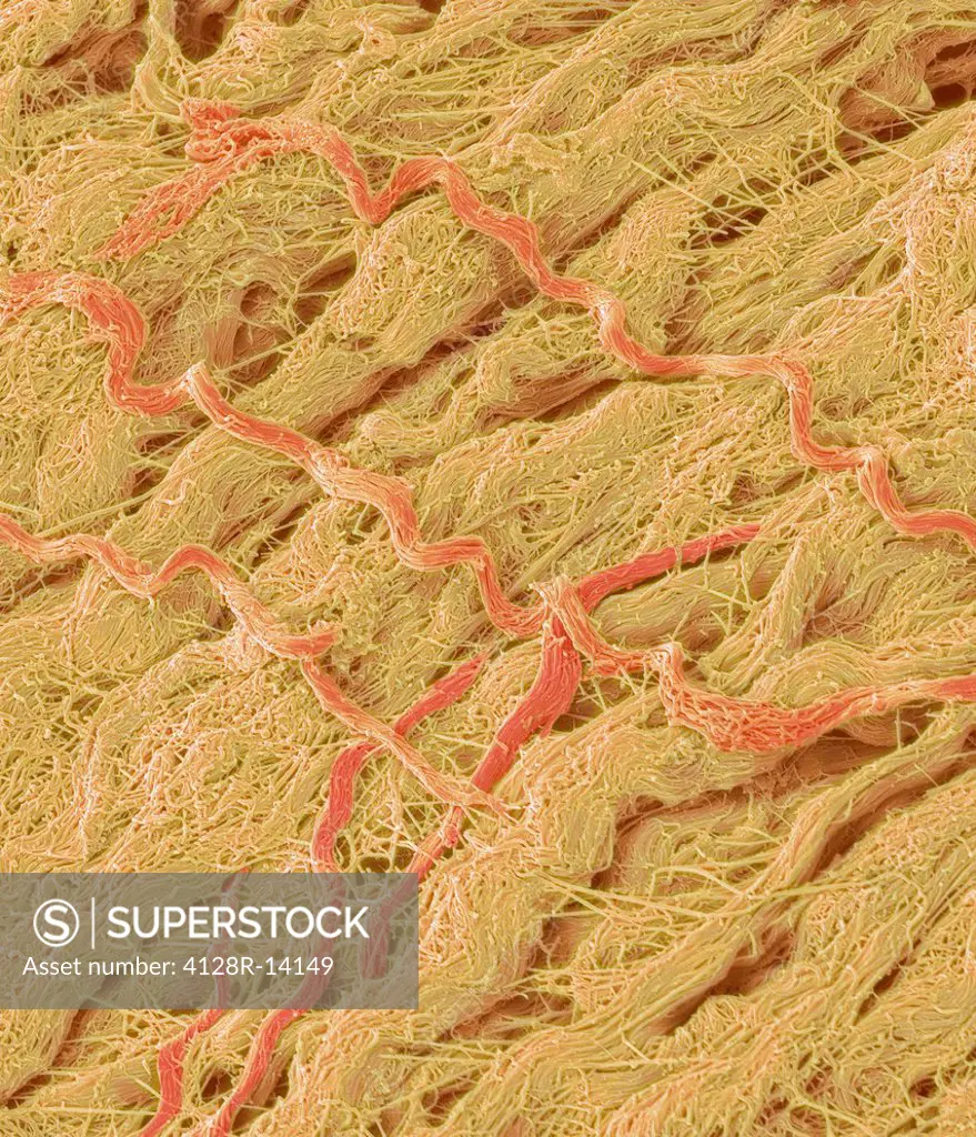 Dense connective tissue, coloured scanning electron micrograph SEM. The main component of this tissue is collagen. Magnification: x1500 when printed a...