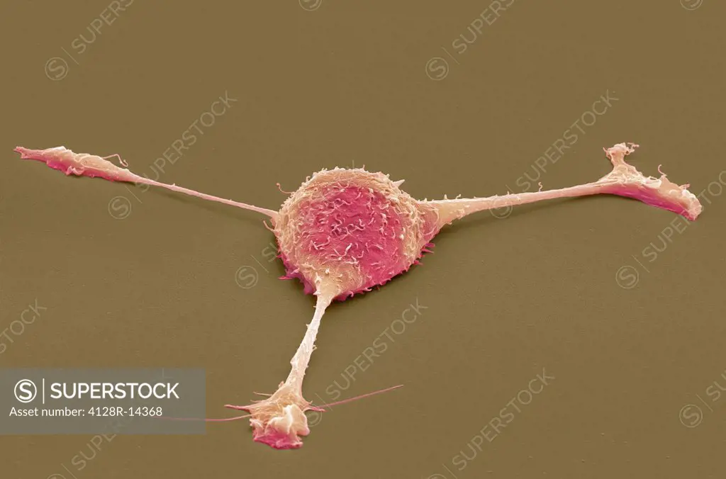 Fibroblast cell, coloured scanning electron micrograph SEM. Fibroblasts are cells that give rise to connective tissue such as collagen, the main struc...