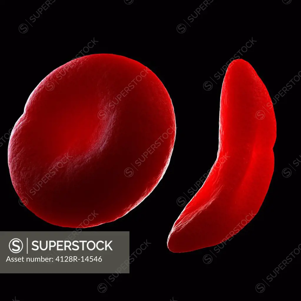 Sickle cell anaemia, computer artwork.