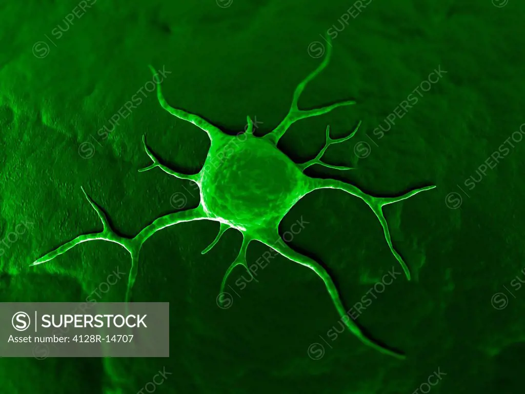 Cancer cell, conceptual computer artwork. The uneven surface and cytoplasmic projections are characteristic of cancer cells.