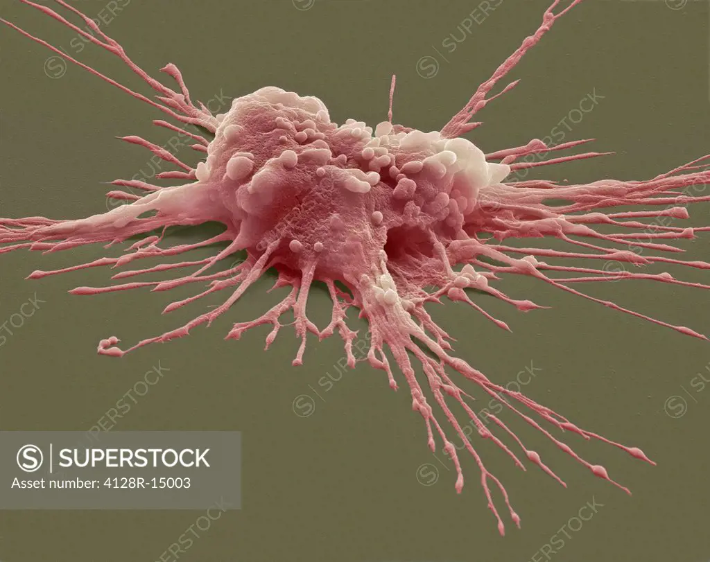 Pluripotent stem cell. Coloured scanning electron micrograph SEM of a pluripotent stem cell derived from a macrophage white blood cell. Magnification:...