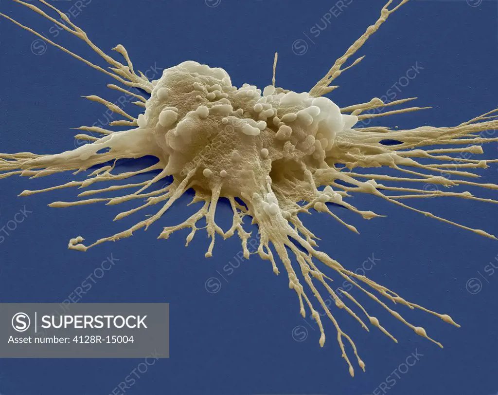 Pluripotent stem cell. Coloured scanning electron micrograph SEM of a pluripotent stem cell derived from a macrophage white blood cell. Magnification:...