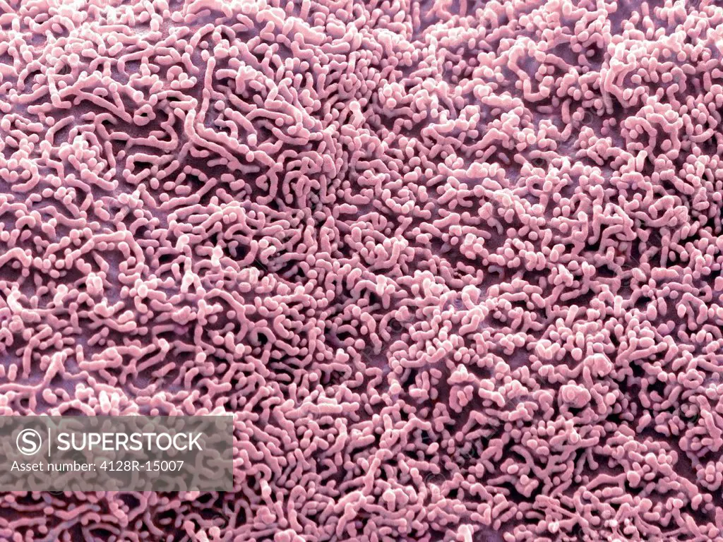 Ureter lining. Coloured scanning electron micrograph SEM of the surface of a squamous epithelial cell from the ureter. Magnification: x6,500 when prin...