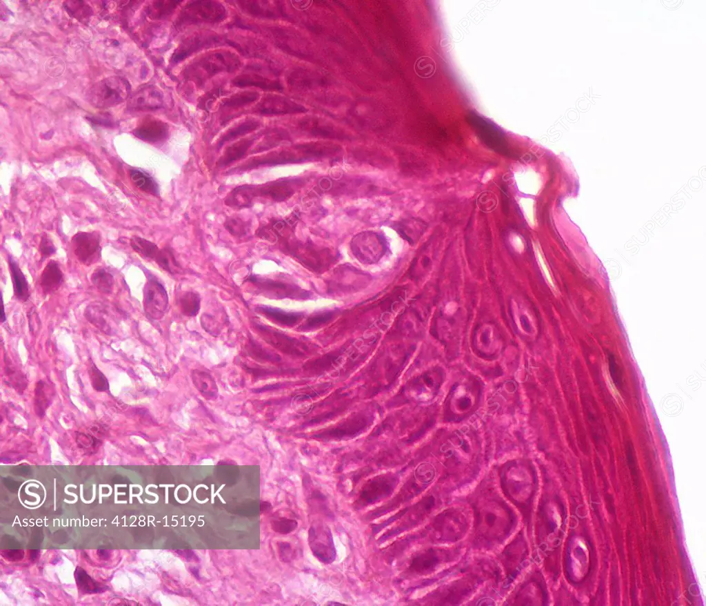 Taste buds Light micrograph of a section through a tongue showing a tastebud upper centre.