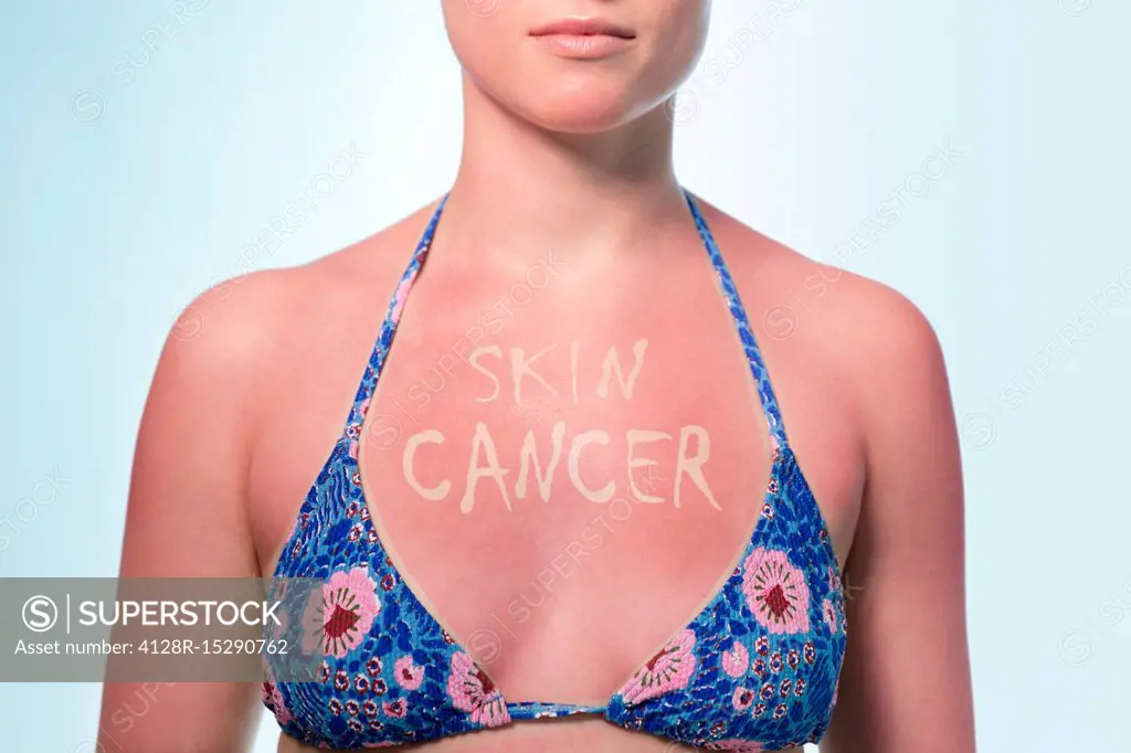 Skin cancer from sun damage, conceptual image
