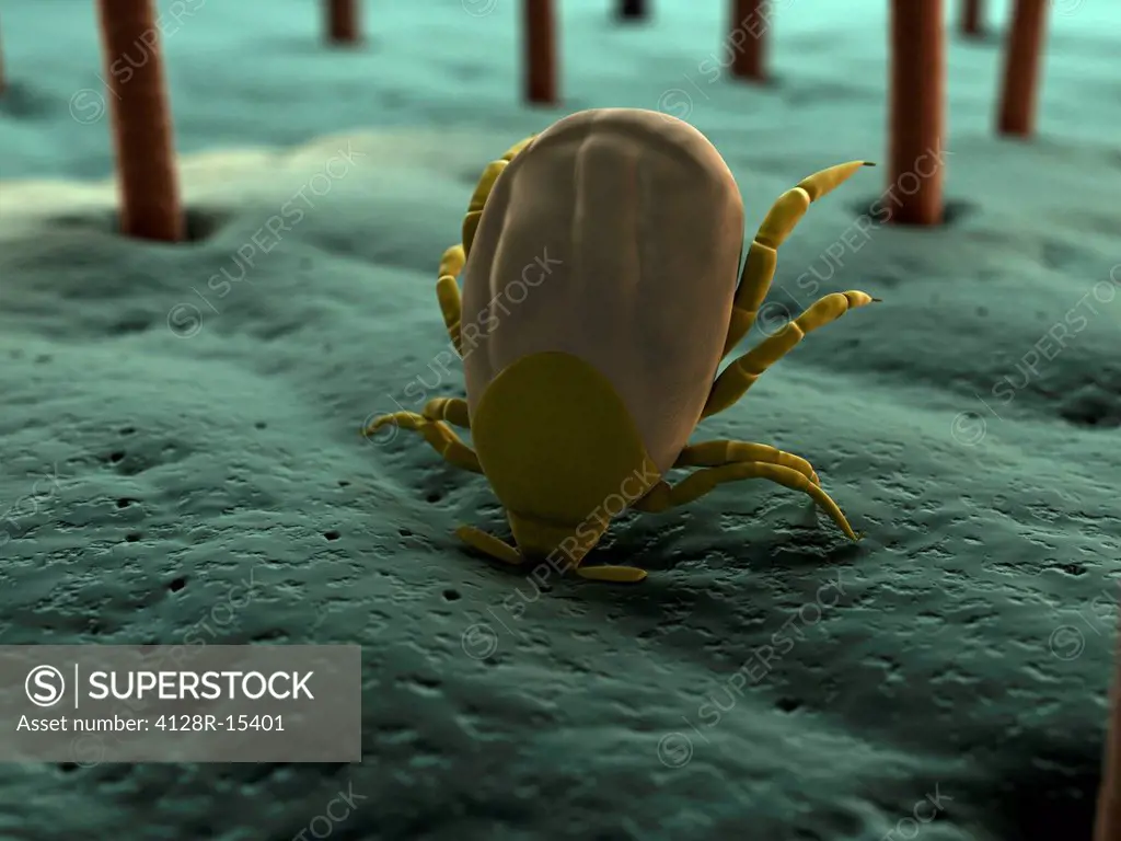 Tick. Computer artwork of a tick superfamily Ixodoidea biting skin.