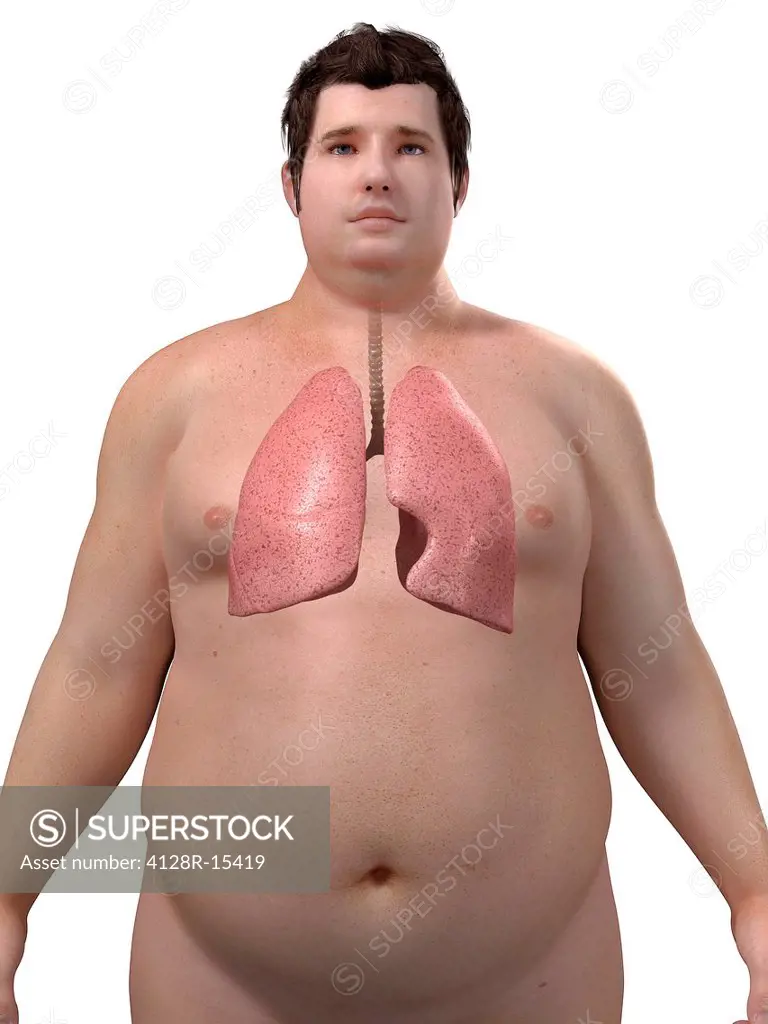 Obese man´s lungs, computer artwork.
