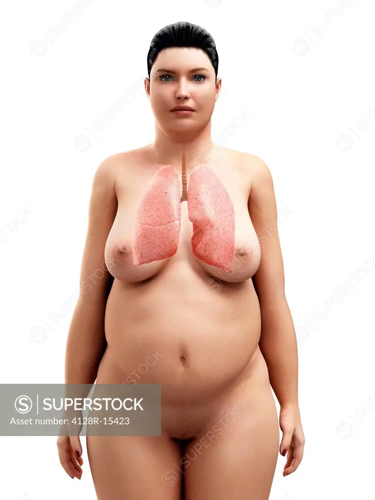 Obese woman´s lungs, computer artwork.