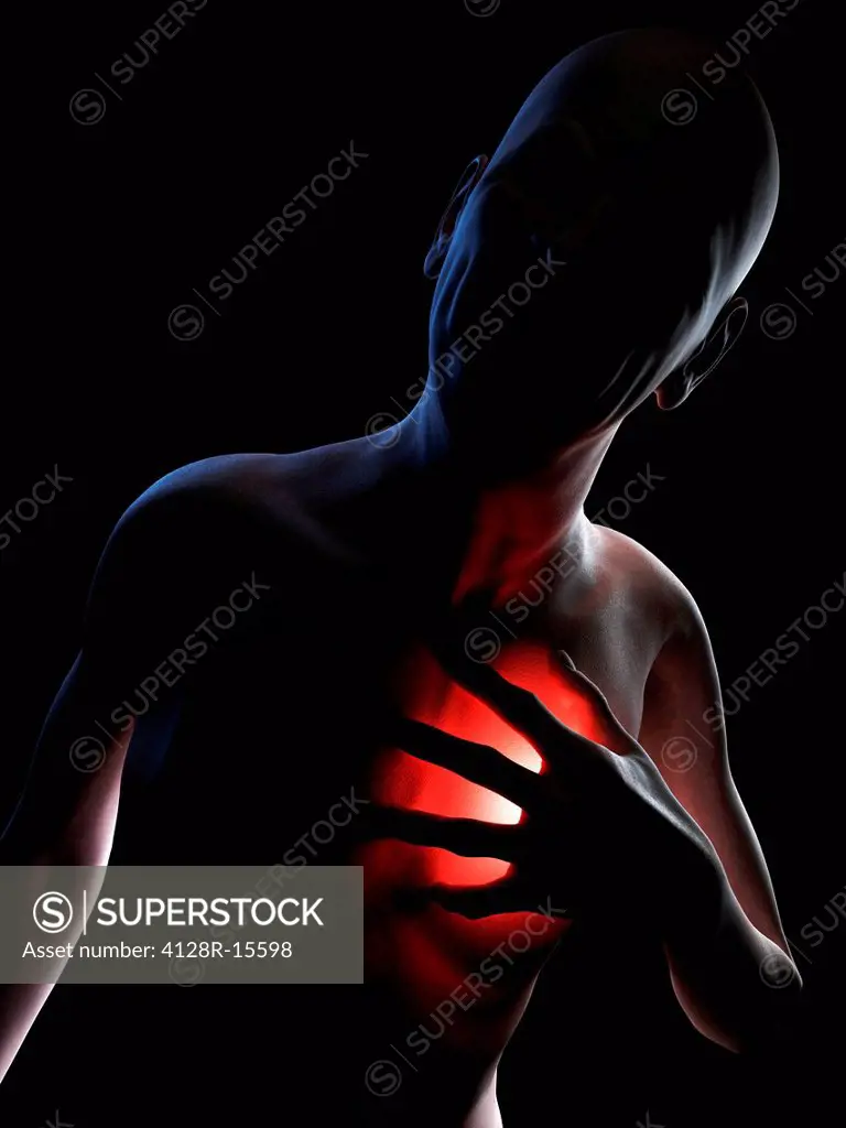 Heart attack, conceptual computer artwork.