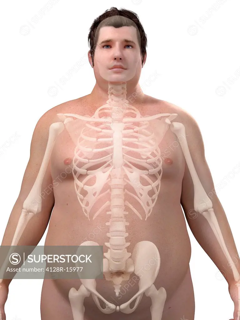 Obese man´s skeleton, computer artwork.