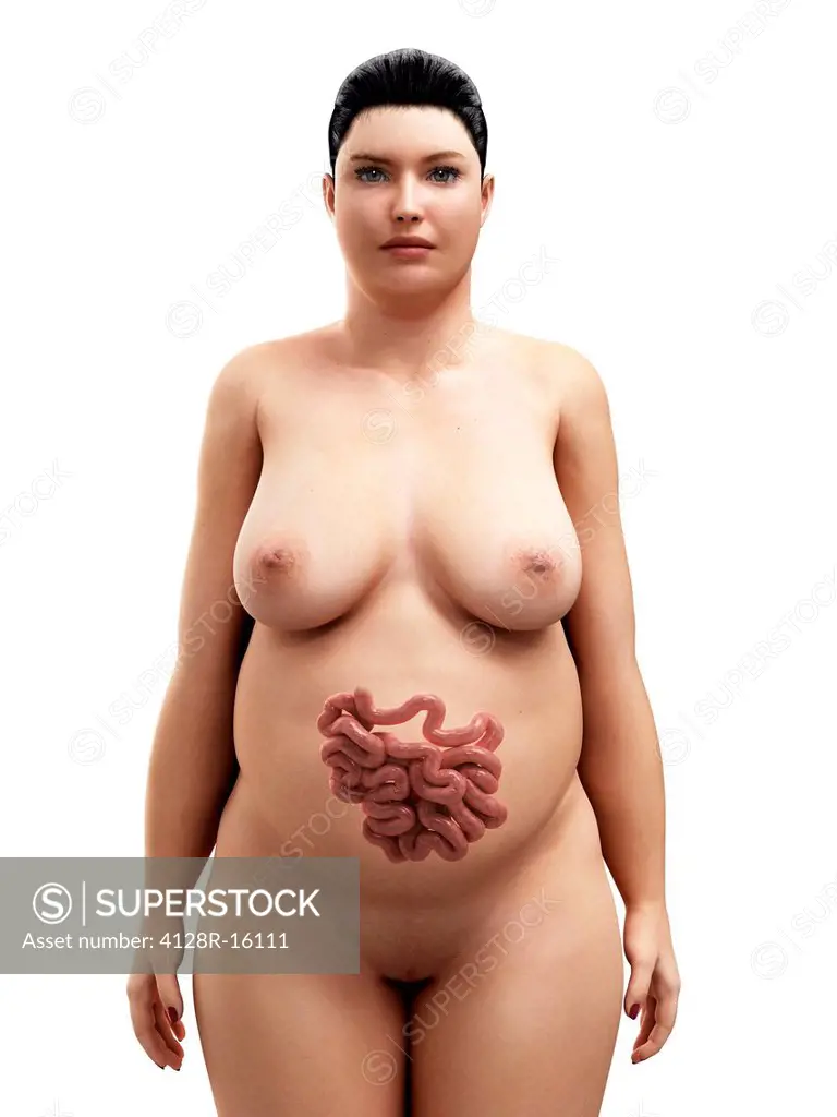 Obese woman´s small intestines, computer artwork.