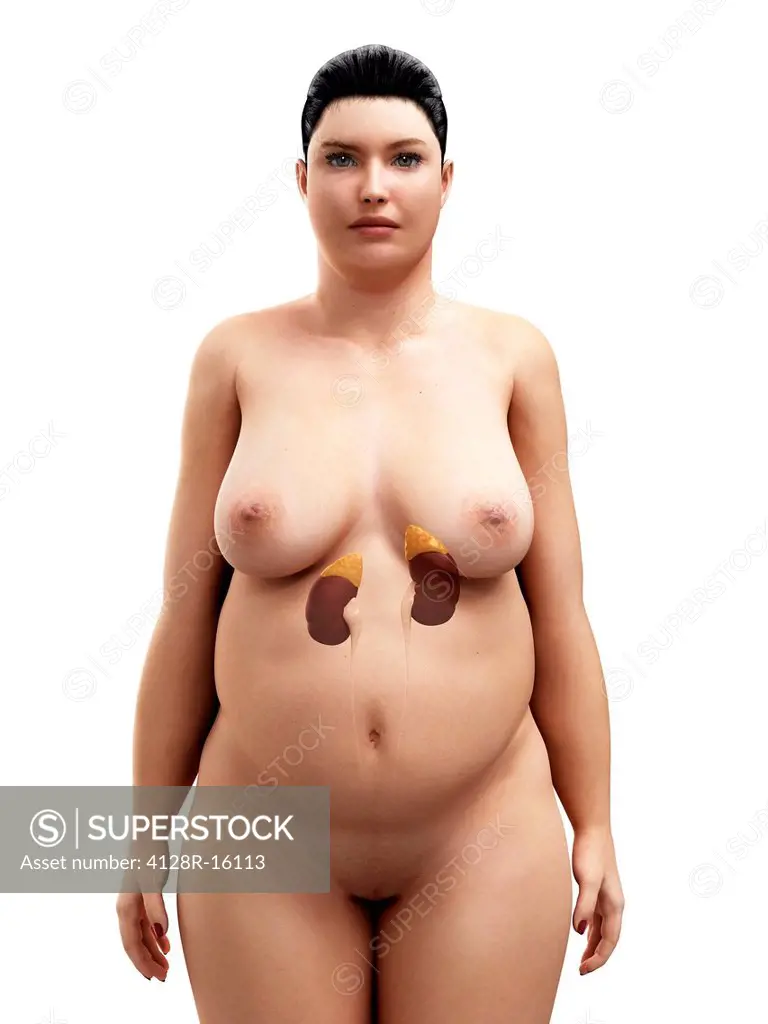 Obese woman´s kidneys, computer artwork.
