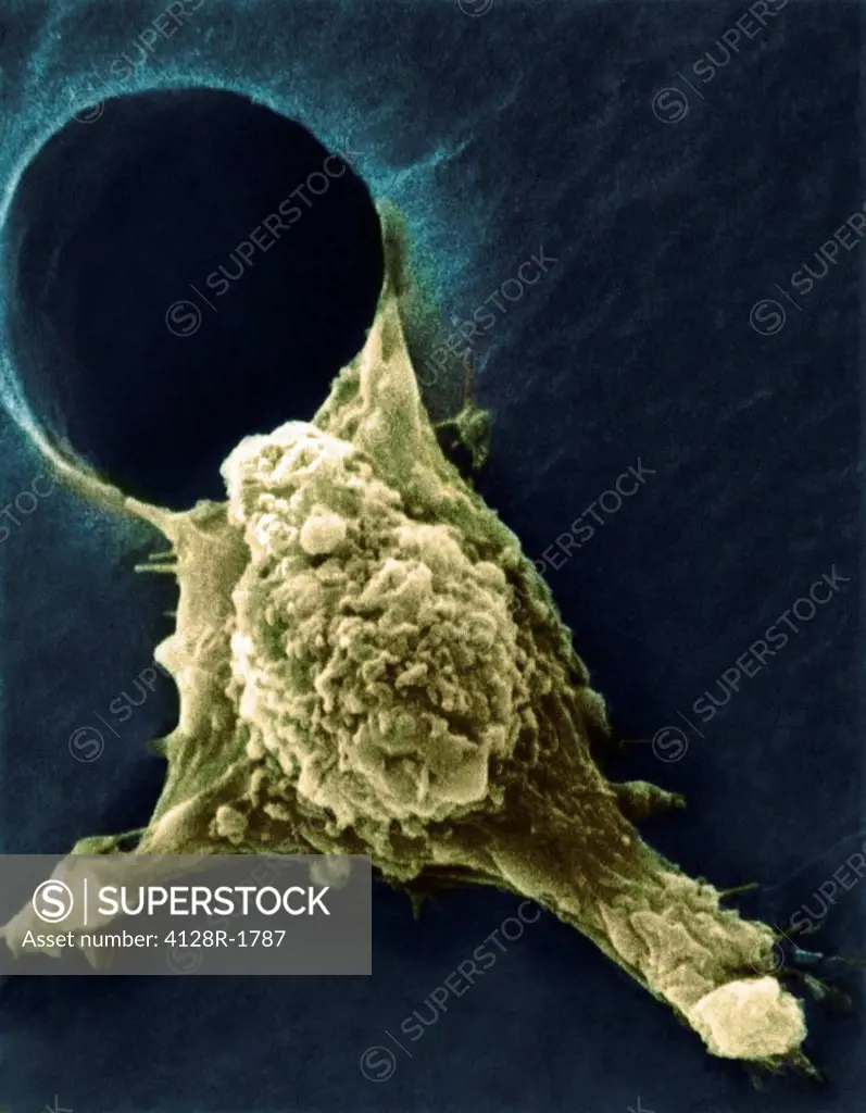 Metastasis of a cancerous cell, SEM