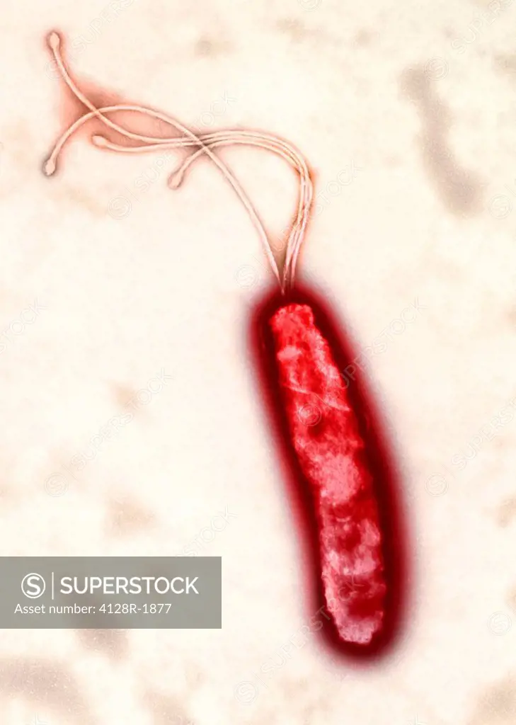Helicobacter pylori bacterium, TEM