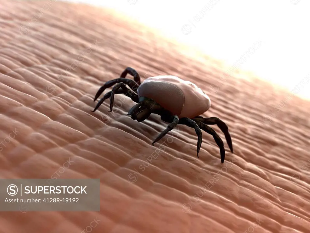 Tick superfamily Ixodoidea on human skin, computer artwork.