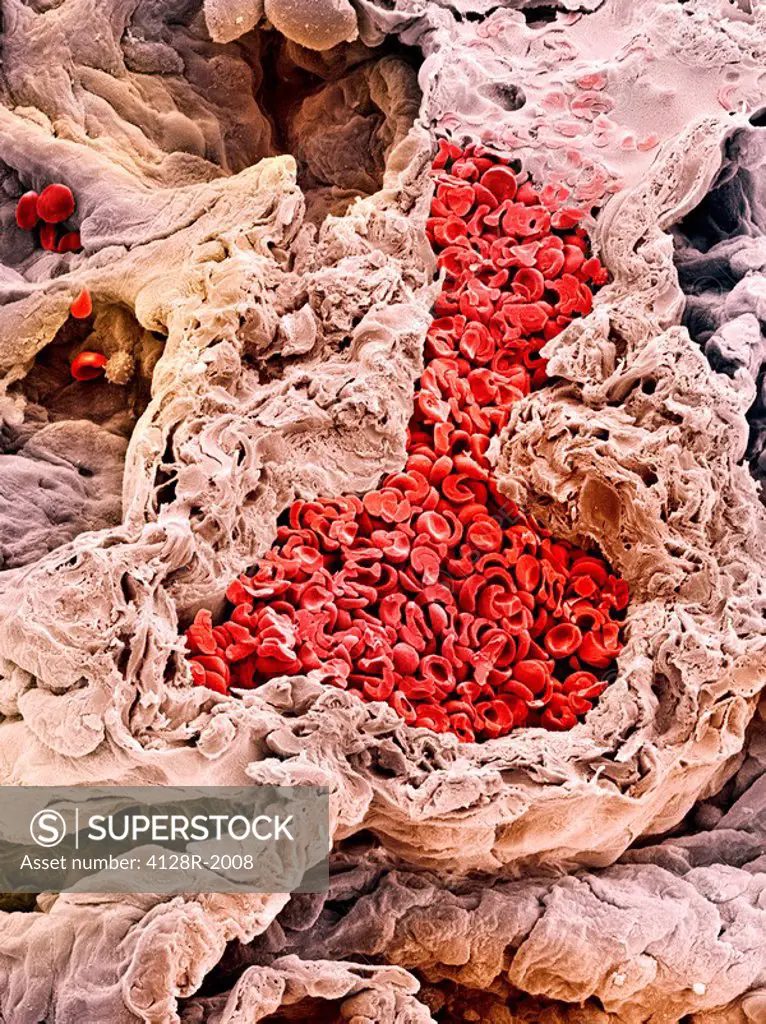Lung blood vessel, SEM