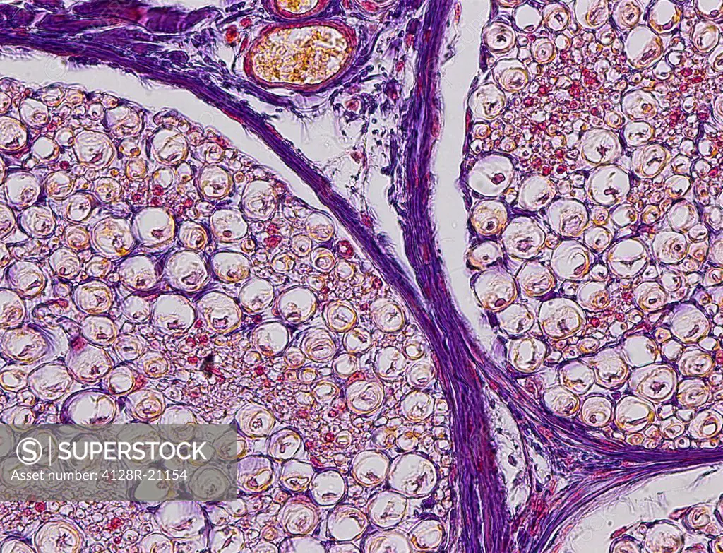 Nerve fibres, light micrograph