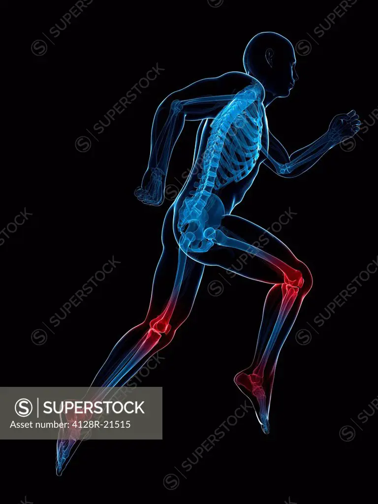 Running injuries, conceptual computer artwork.