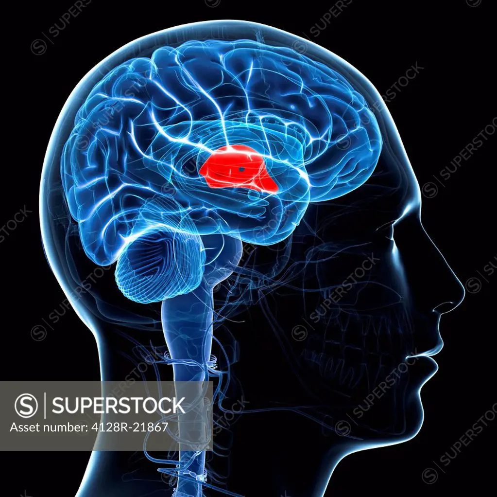 Third ventricle. Computer artwork of the brain showing the third ventricle red, which is filled with cerebrospinal fluid and cushions the brain.