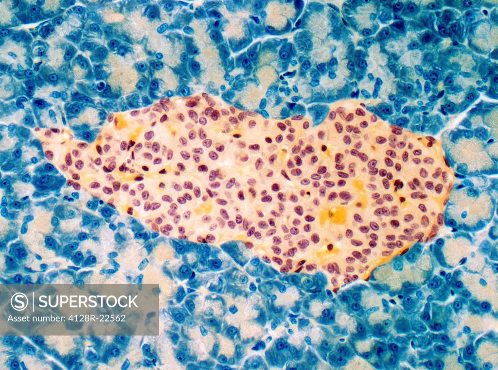 Islet of langerhans, light micrograph. This structure centre, found in the pancreas, secretes the hormones insulin and glucagon, which control blood s...