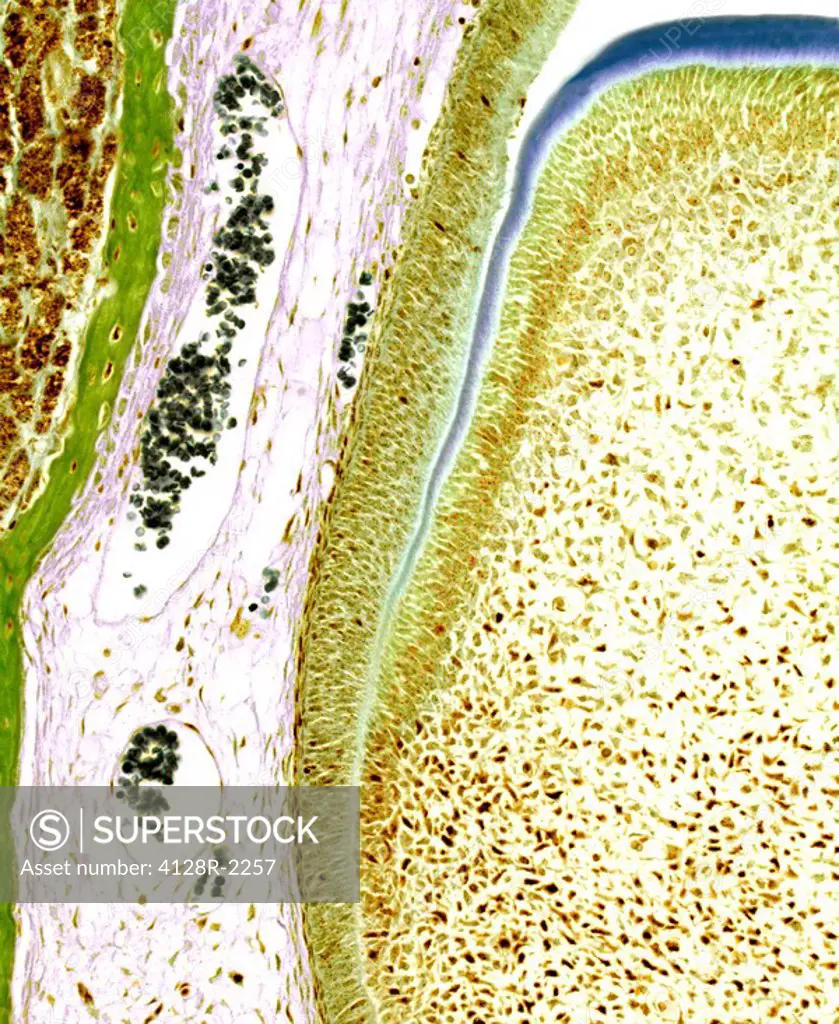 Developing tooth, light micrograph. At centre are odontoblasts yellow overlaying the dental pulp. A layer of dentine blue surrounds the pulp. The oute...