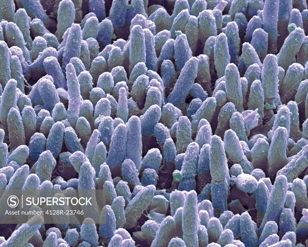 Dental plaque. Coloured scanning electron micrograph SEM of dental plaque. Plaque consists of a film of bacteria embedded in a glycoprotein matrix. Th...