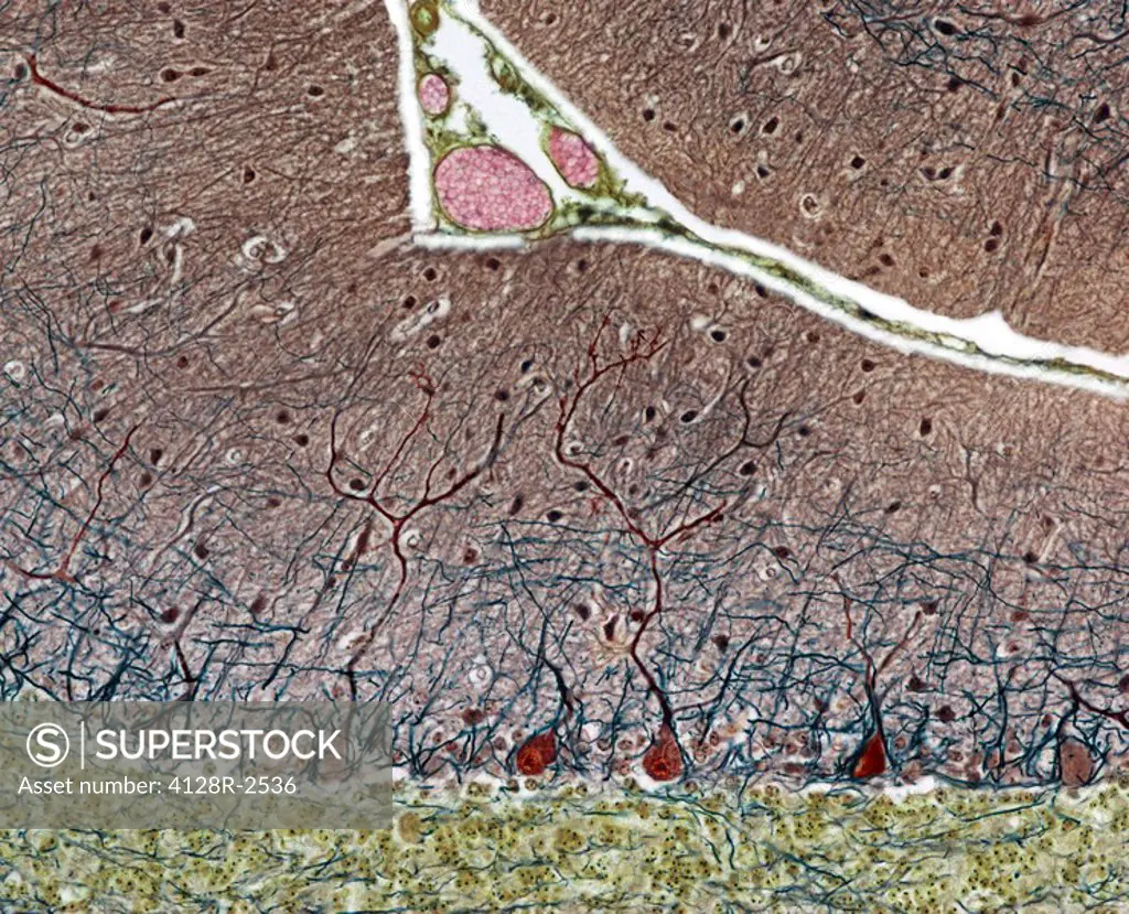 Purkinje cells. Light micrograph of a section through the cerebellum, which has been treated with silver stains, showing pukinje cells dark brown and ...